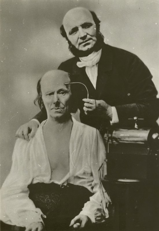Neurologue français Duchenne de Boulogne utilisant son appareil d