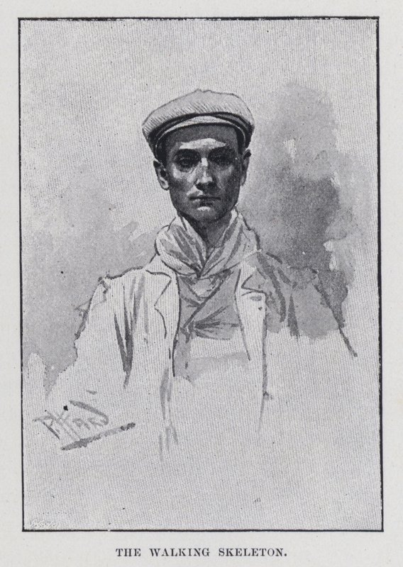 Le squelette ambulant - Harold Hume Piffard