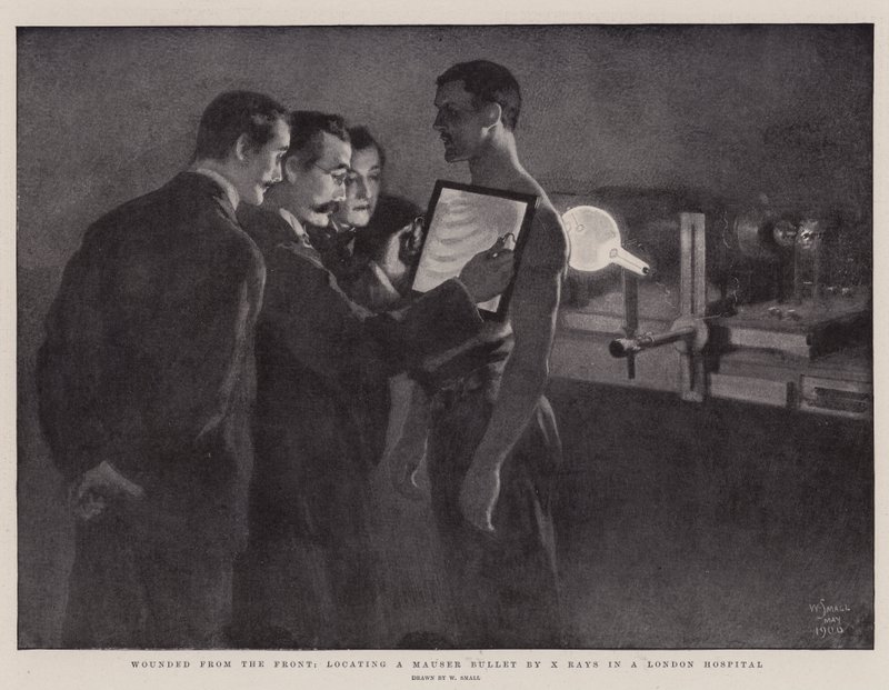 Blessés du front, localisation d