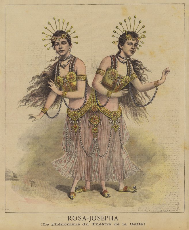 Jumeaux siamois - after Henri Meyer