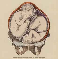 Position normale des jumeaux dans l