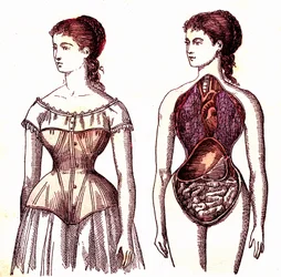 Compression du corset - La Vie Normale et Santé par J. Rengade. Dessin de A. Demarle 1881