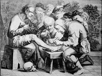 Chirurgie de la cheville (gravure)