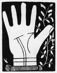 Chiromancie - Double ligne solaire se brisant au milieu - Gravure de 1545 dans « L