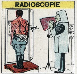 Rayons X : radioscopie d