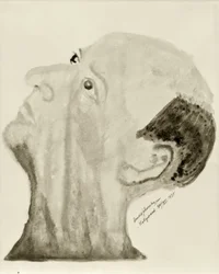 Autoportrait