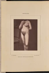 Syphilide vésiculeuse généralisée