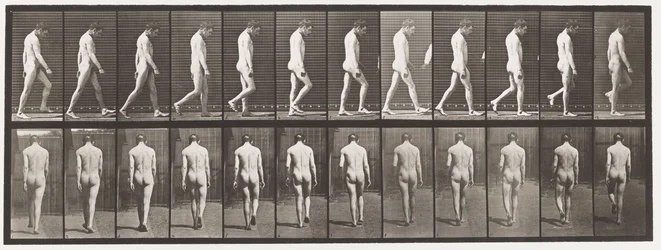 Planche 549. Épilepsie ; marche