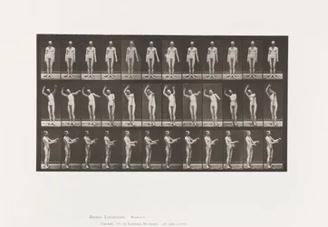 Chorée locale; A, B, C, en position debout