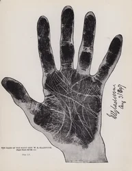 La main du très honorable W E Gladstone (photo n/b)