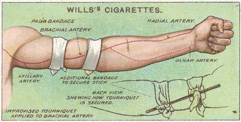 Garrot, no.11 de la série Premiers Secours des cartes de cigarettes Willss, 1913