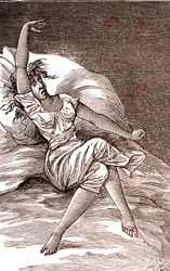Maux de tête, mélancolie et hystérie, anxiété. 1887 (gravure)