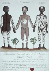 Le Phénomène de la Leucodermie