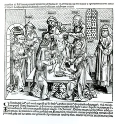 Circoncision, de 