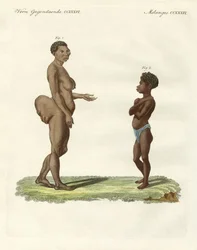 Variétés humaines étranges