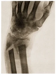 Radiographie d