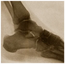 Radiographie d