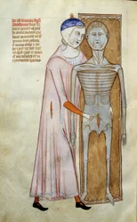 Médecine : planche anatomique et chirurgicale représentant une scène de dissection
