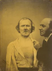 Pleurs, larmes de pitié (gauche); Visage détendu (droite)