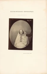 Électro-Physiologie Photographique, Figure 76