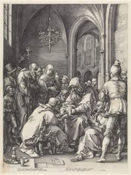 La circoncision
