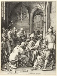 La circoncision