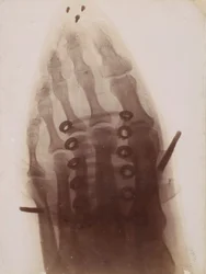 Le pied à travers la chaussure, 1896