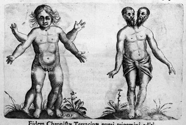 Différents types de monstres humains. Gravure tirée de « De monstrorum natura, causis et differentiis » par Fortunio Liceti (1577-1656), scientifique italien. 1646