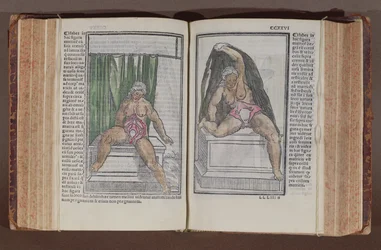 Anatomie féminine, de Commentaria cum amplissimis additionibus super anatomiam mundini, par Jacopo Berengario da Carpi, publié à Bologne, 1521 (gravure sur bois en couleur)