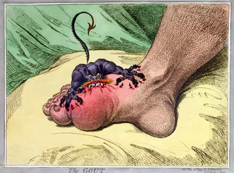 La goutte, publié par Hannah Humphrey en 1799