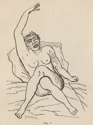 Épilepsie hystérique, attaque, contorsions, fig. 1 de 