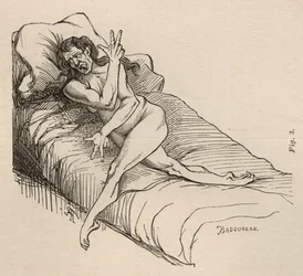 Épilepsie hystérique, attaque, contorsions, fig. 3 de 