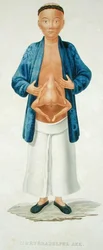 Homme chinois avec un jumeau conjoint non développé attaché à son abdomen, illustration d