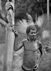 Malformation des oreilles, Îles Salomon, 1920