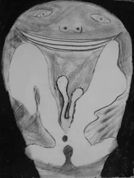 disco, 2010 (lithographie)