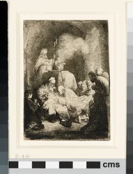 La circoncision
