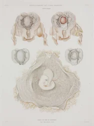 Gynécologie Utérus humain avec embryon, vers 1847-1859
