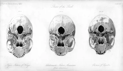 Base du crâne, 1848