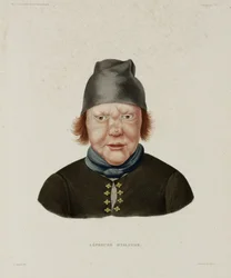 Maladies, Lèpre, Lépreuse, Islande, début du 19e siècle