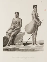 Maladies, maladies tropicales