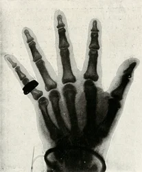 Radiographie de la main de S.A.R. le prince de Galles, vers 1897