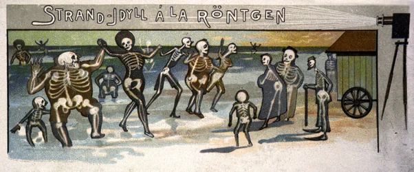Idylle de plage à Röntgen, vers 1900 (illustration)