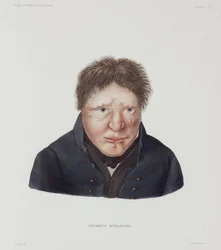 Maladies, lèpre Homme lépreux, Islande, début du 19ème siècle