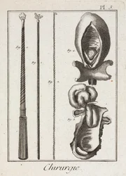 Équipement, instruments chirurgicaux de l