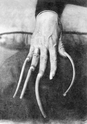 Particularité monstrueuse : une main avec des ongles très longs. Chine vers 1910. Photo historique, ongles longs, Chine, vers 1910.