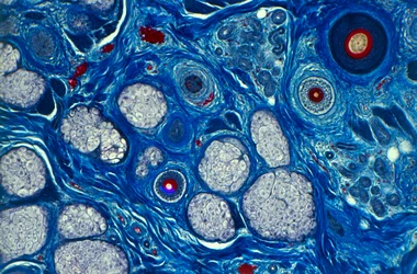 Peau humaine, avec tiges pilaires et pores - Peau humaine vue au microscope, montrant la tige du cheveu et les pores de sueur ©Spike Walker (Microworld Services)/Dorling Kindersley/UIG/Leemage