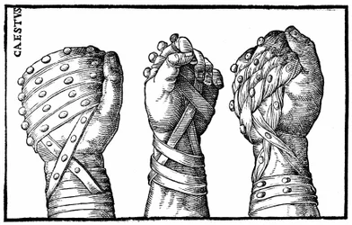 Gants de boxe pour lutteurs romains - dans "Hieronymi mercurialis de Gymnastica", édition de Venise