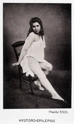 Hystéro-épilepsie - Contracture dans « Iconographie photographique de la Salpêtrière : service de M. Charcot » par Paul Regnard et Bourneville