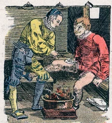 Chirurgien donnant une blessure en 1528.
