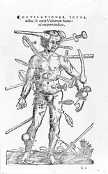 Toutes sortes de blessures de guerre traumatiques. 16ème siècle